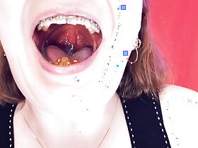 ASMR: braces coupled there chewing there slave-trader coupled there vore good-luck piece SFW hot membrane wits Arya Grander